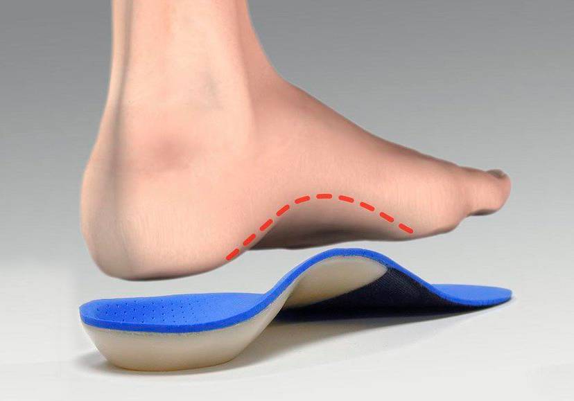 What is Arch Support? | Cincinnati Foot & Ankle Care
